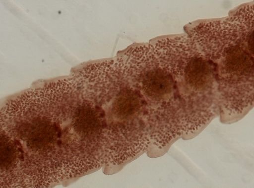 Eucestoda