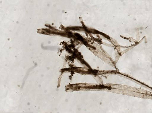 Victorella pavida