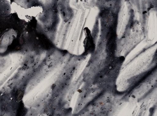 Entamoeba histolytica