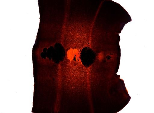 Diphyllobothrium erinacei
