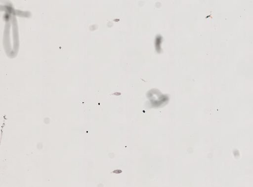 Protohydra leuckarti