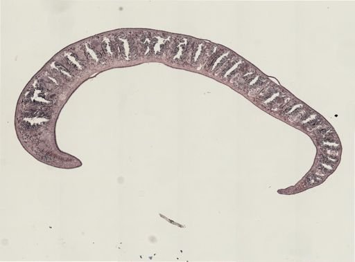 Foviella