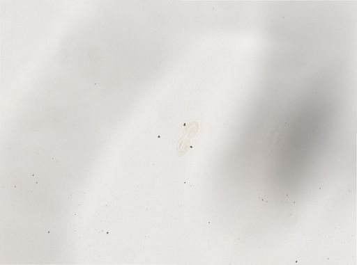 Paramecium