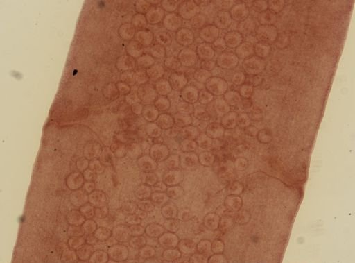 Dipylidium caninum