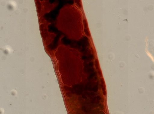 Platyhelminthes