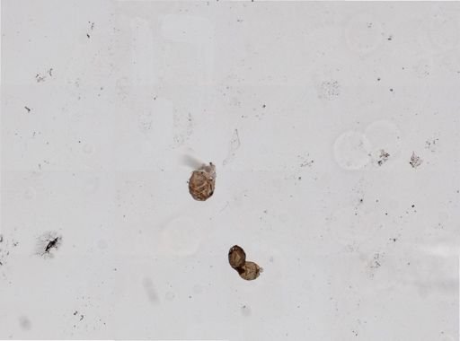 Distomum