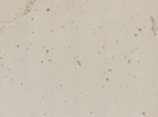Paramecium