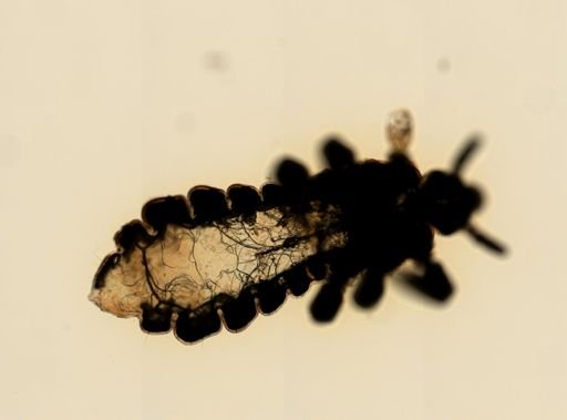 Pediculus humanus
