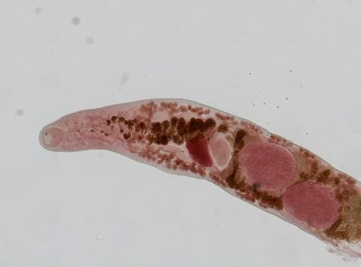 Haematoloechus medioplexus