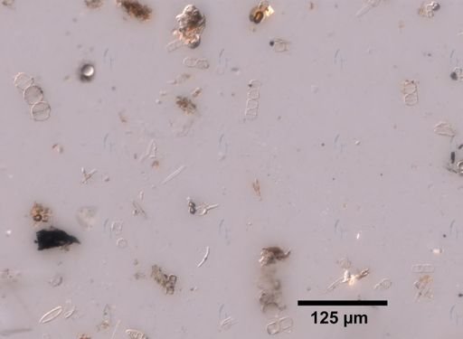 Diatoms