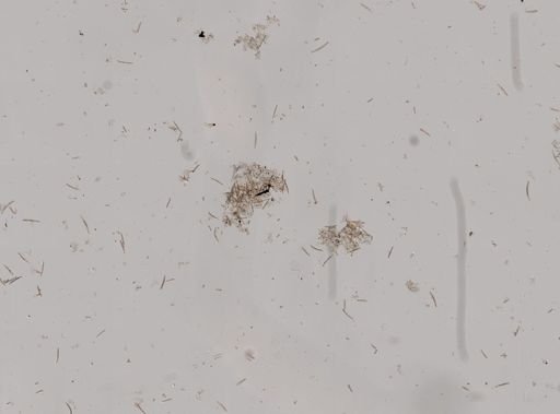 Spongilla fragilis