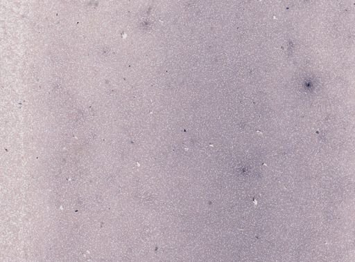 Trypanosoma brucei gambiense