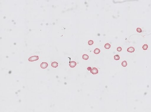 Edwardsia sp.