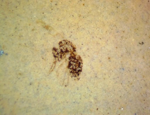 Hymenoptera?