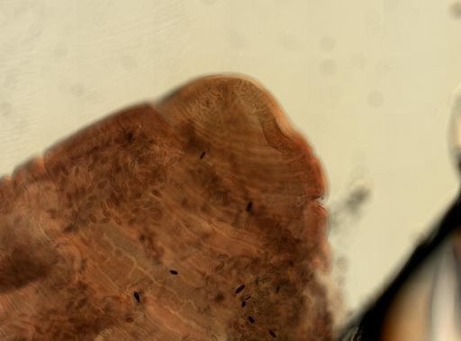 Oligacanthorhynchus microcephalus