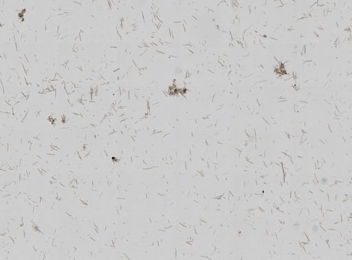 Callyspongia vaginalis