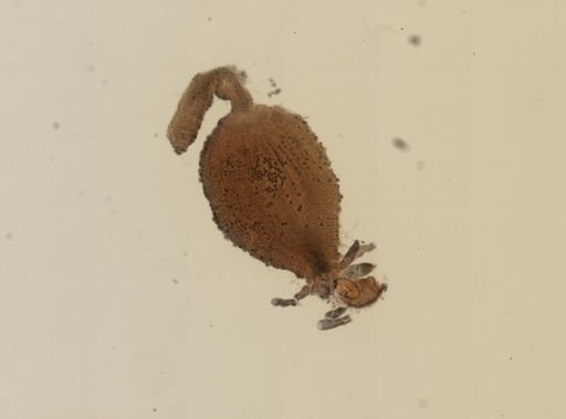 Plasmodium vivax