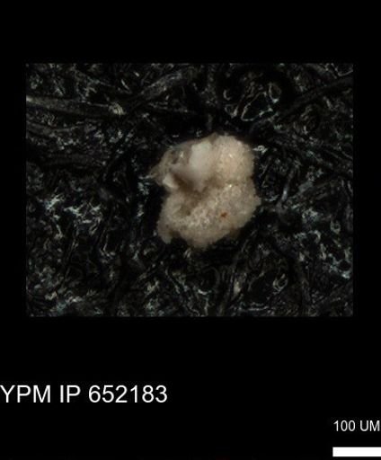 undet. Rugoglobigerinidae