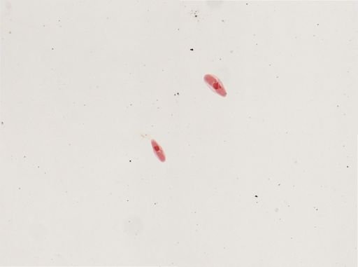 Paramecium calkinsi