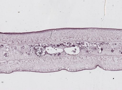 Taenia saginata