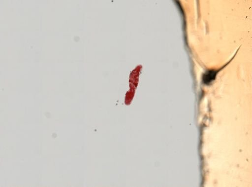 Trematoda