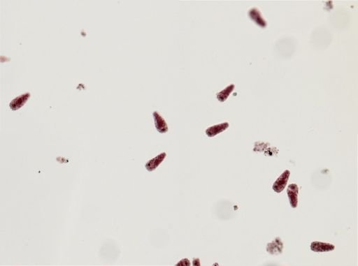 Fasciola hepatica