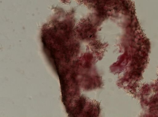 Toxadocia sp.