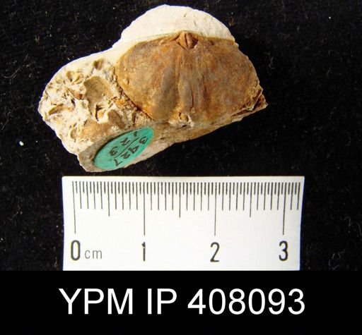 Metaplasia?