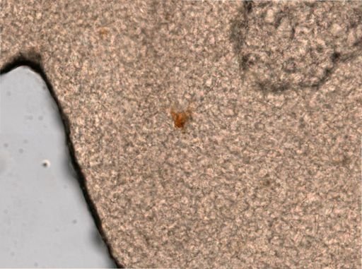 Lepadella imbricata