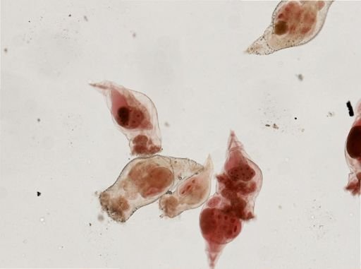 Epiphanes senta
