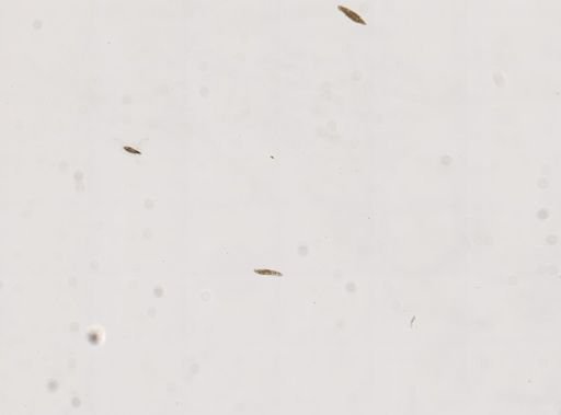 Paramecium