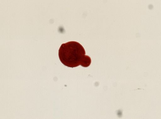 Tetracotyle