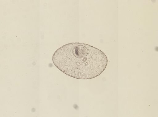 Dicrocoelium dendriticum