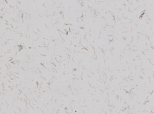 Hymedesmia arndti