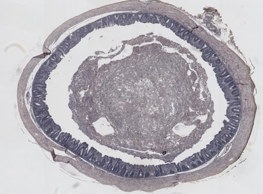 Eimeria meleagrimitis
