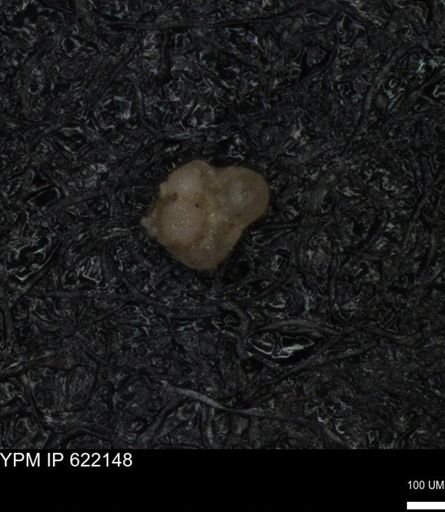 undet. Foraminiferida