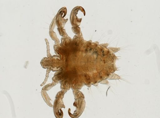 Pthirus pubis