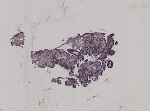 Crepidula convexa
