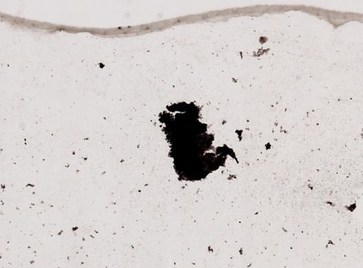 Pleistophora macrozoarcides