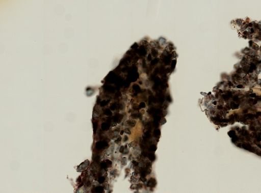 Cliona undulatus