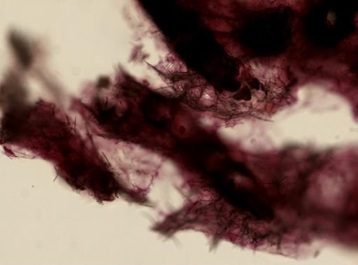 Lissodendoryx noxiosa