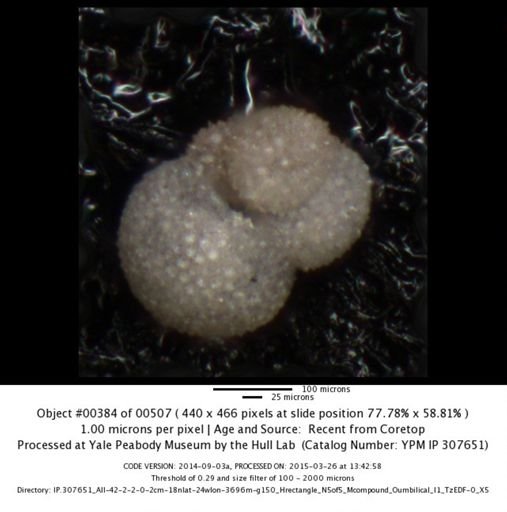 Globigerinoides sacculifer