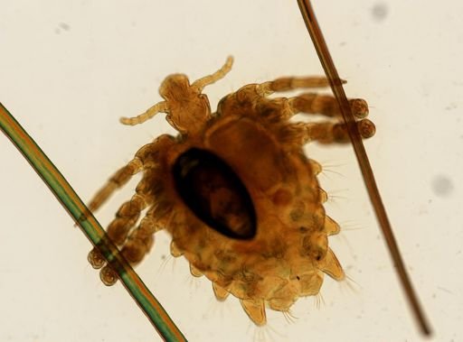Pthirus pubis
