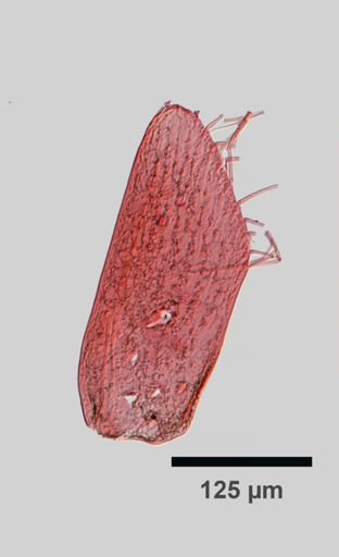 Caecidotea
