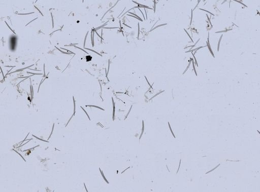 Spongilla aspinosa?