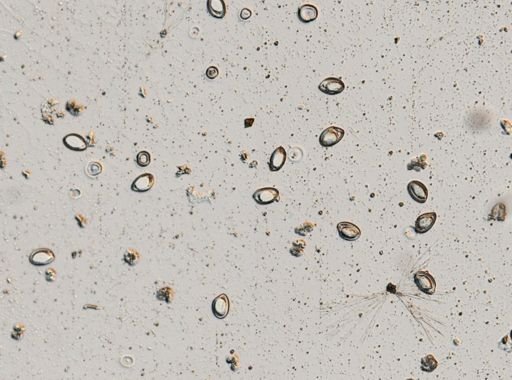 Enterobius vermicularis