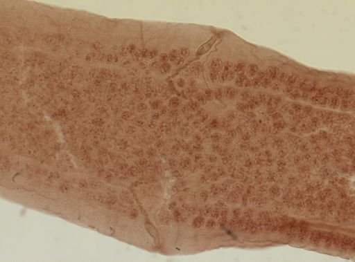 Dipylidium caninum
