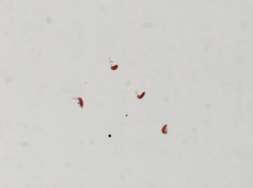 Trematoda