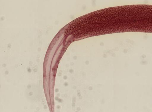 Enterobius vermicularis
