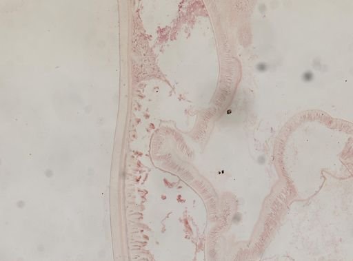Ascaris megalocephala